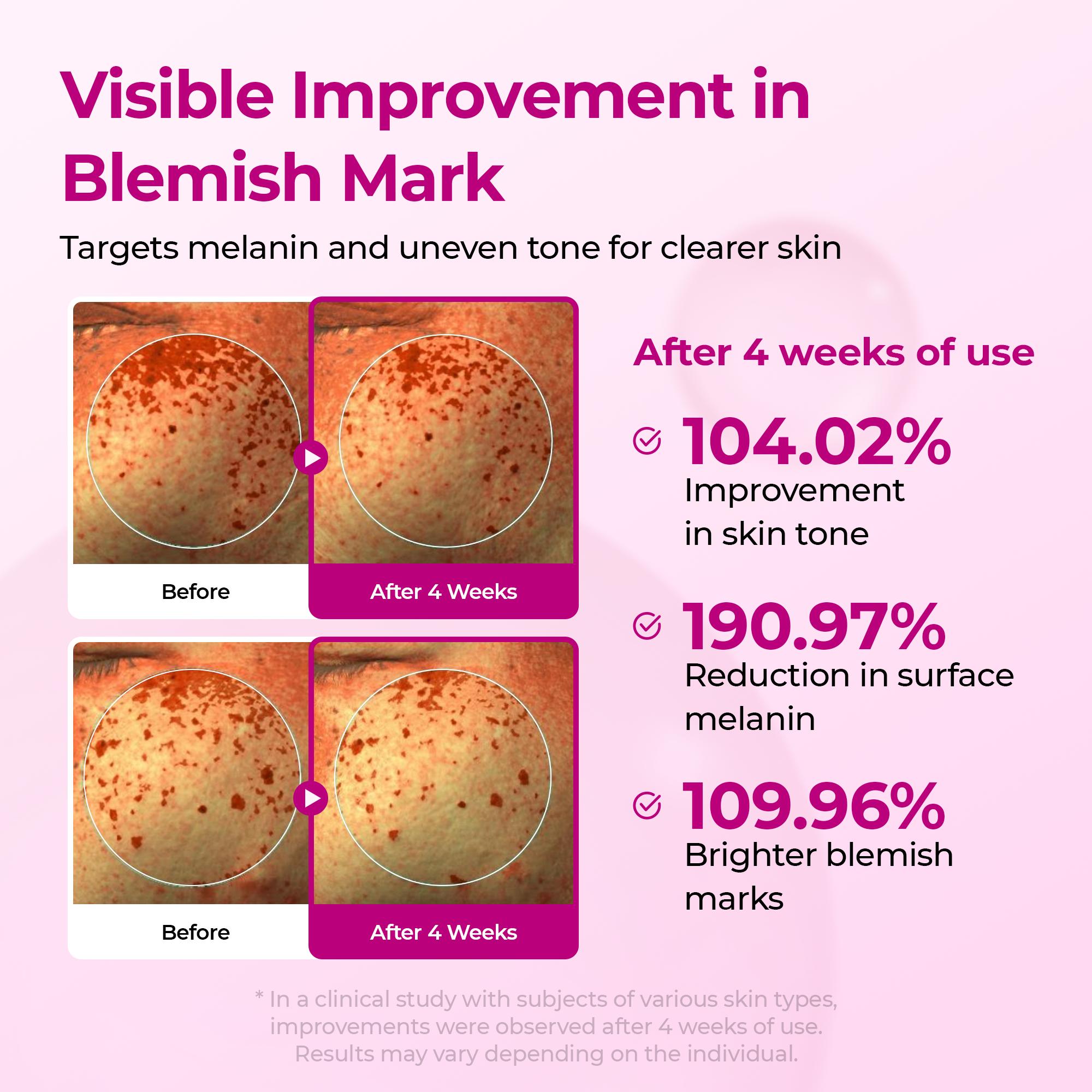 [Dr.Melaxin Official] Complete Brightening Routine | Peel Shot Serum, TX Body Peeling Shot, Kojic Acid Turmeric Capsule Body Cream & Kojic Acid Turmeric Serum Soap 4-Piece Set